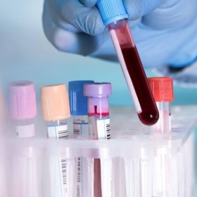Factors affecting haematology testing