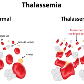 How is thalassemia (inherited haemolytic anaemia) detected?