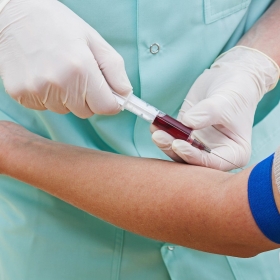 Why you should proactively take a general blood test